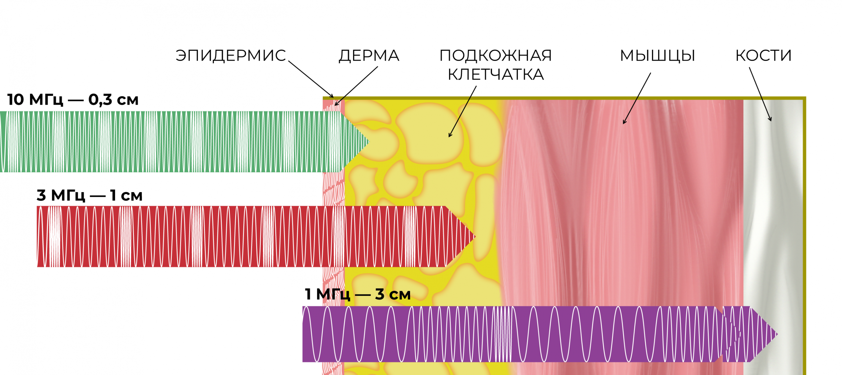 скинова-таблица2.png скинова-таблица2.png